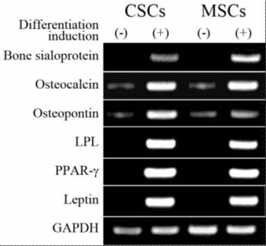 In vitro mesengenic differentiation potential of adult human myocardium derived cardiac stem cells