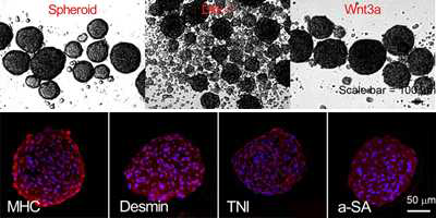 Spontaneous cardiomyogenic differentiation ability of cardiac stem cells derived from the adult human myocardium using 3-dimensional myocardial culture