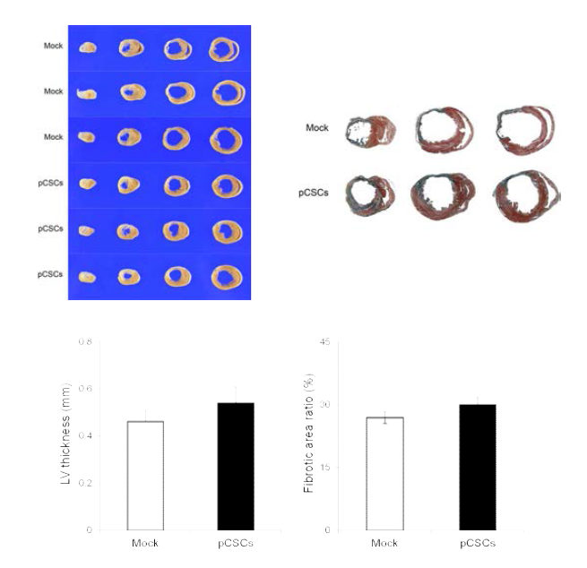 Cardioprotective effect of minipig-derived cardiac stem cells on acute myocardial infarction