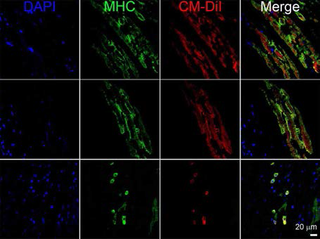 Cardiomyocyte differentiation of transplanted minipig-derived cardiac stem cells