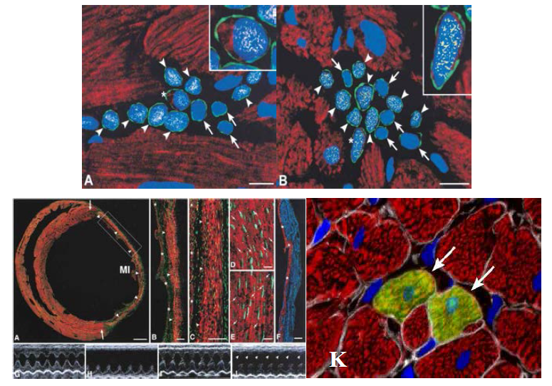 Discovery of endogenous cardiac stem cells resided in postnatal heart