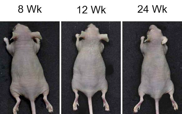 Tumorigenic potential of cardiac stem cells isolated from patient-derived myocardium