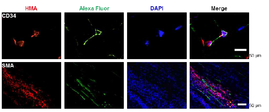 Endothelial differentiation potential of minipig cardiac stem cells in ischemic hindlimb model of nude mouse