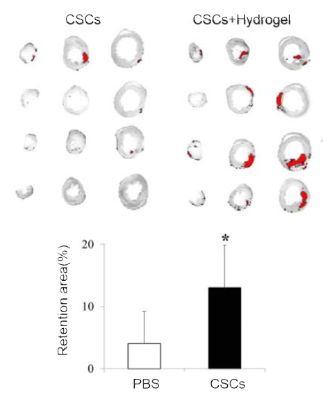 Intramyocardial retention rate of human cardiac stem cells in acutely ischemic hearts of rat