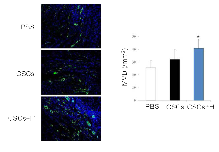 Microvascular density in acutely ischemic hearts of rat injected with PBS or cardiac stem cells