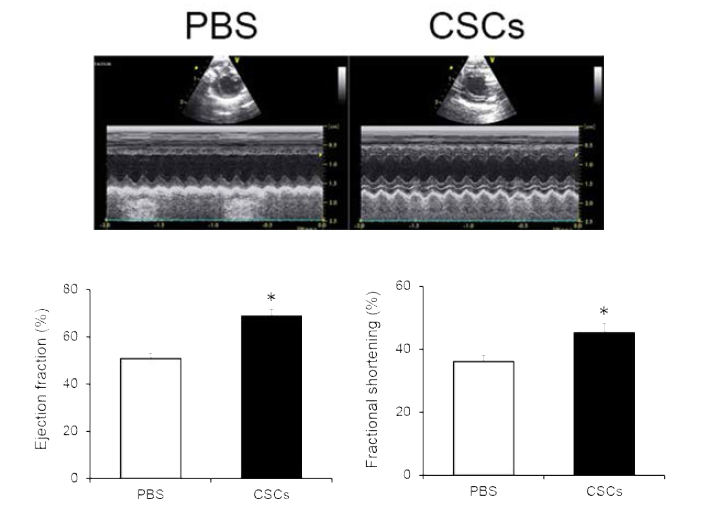 Recovery of cardiac function in acutely infarcted hearts injected with cardiac stem cells or PBS