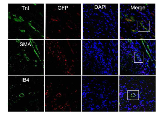 In vivo cardiac differentiation potential of human cardiac stem cells injected into acutely infarcted myocardium of rats