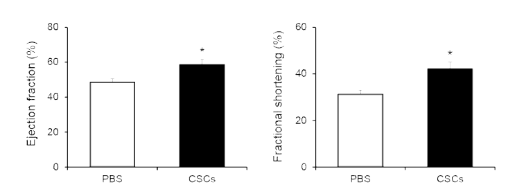 Recovery of cardiac function in chronic myocardial infarction model of rats injected with human cardiac stem cells