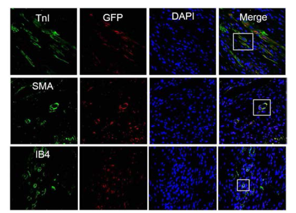 In vivo cardiac differentiation potential of human cardiac stem cells injected in chronic myocardial ischemia model of rats