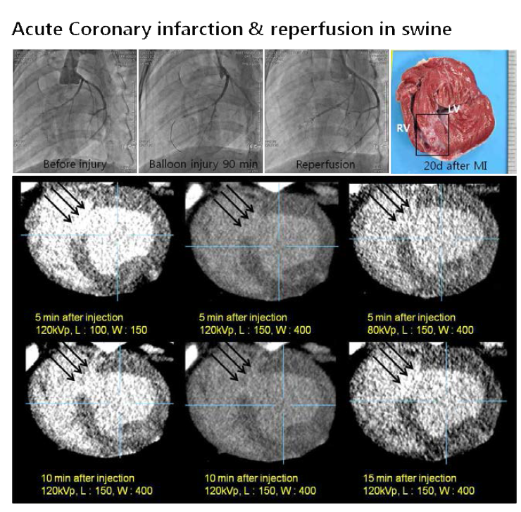 Swine AMI model에서의 Cardiac CT scan 기법을 이용한 심근 손상분석기법 확립
