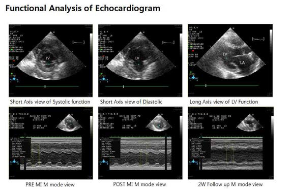 Functional analysis of echocardiogram