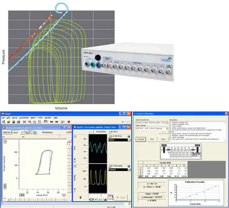 Millar PV loop system을 이용한 좌심실 기능 평가