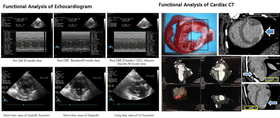 Functional analysis of echcardiogram and cardiac CT