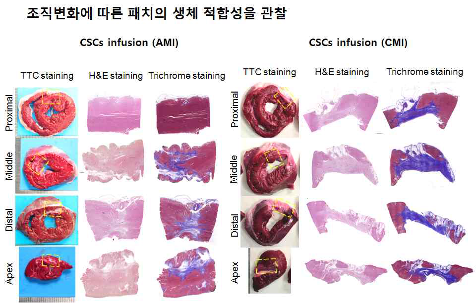 심장재생유도체의 coronary infusion 적용 부위의 조직학적 변화