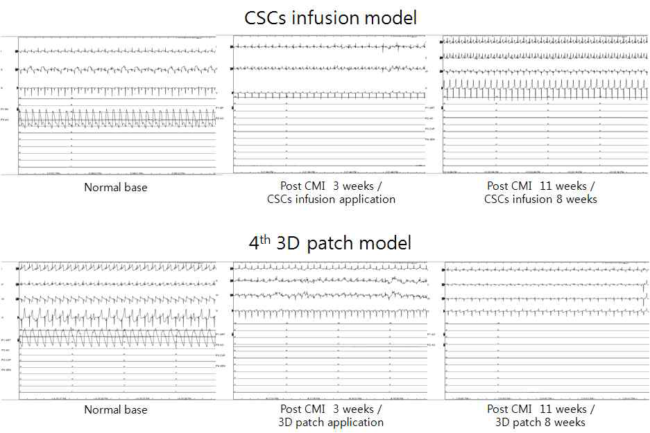 반복적인 Electrocardiography pattern 검사 및 부정맥 추적검사