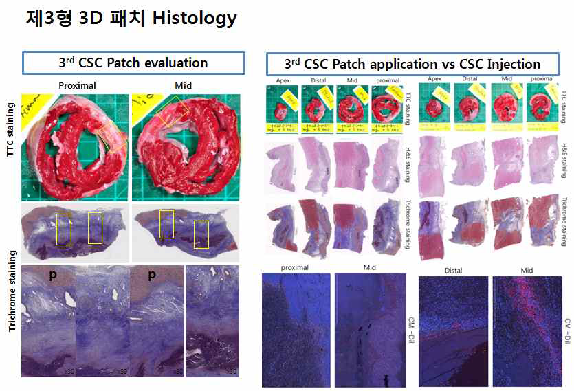3D 패치형 심근재생 유도체의 생채 적합성 유효성 평가 (제3형)