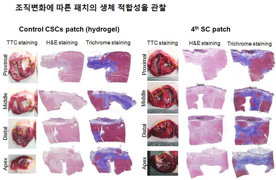 제4형 3D 패치와 대조군 패치(hydro-gel 지지체) 적용 부위 조직학적 변화