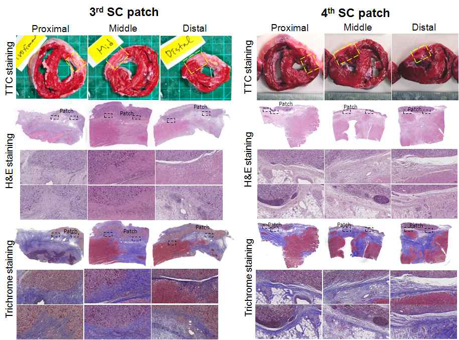 제3형과 제4형 3D 패치 적용 부위 조직학적 변화의 비교