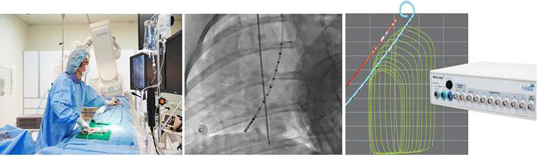 Left ventricular 에서의 hemodynamic analysis를 통한 심장기능평가