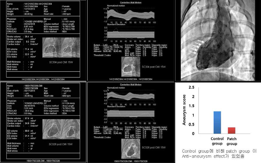 Angiogram을 이용한 anti-aneurysm effect 의 관찰