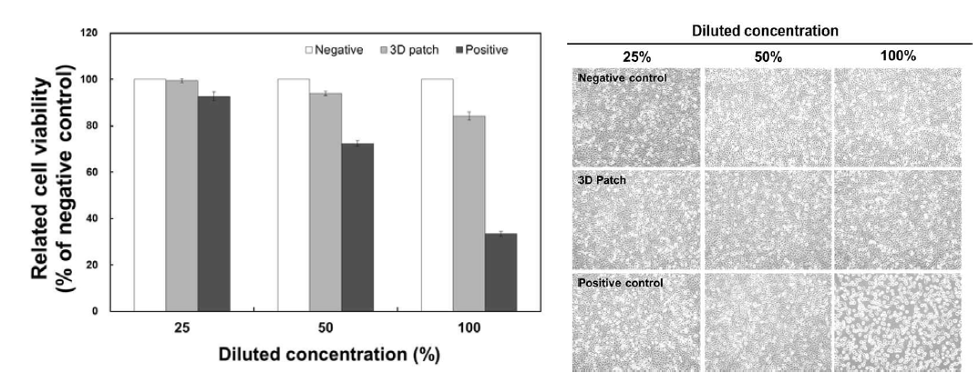 3D 패치 추출액의 세포독성 시험 결과