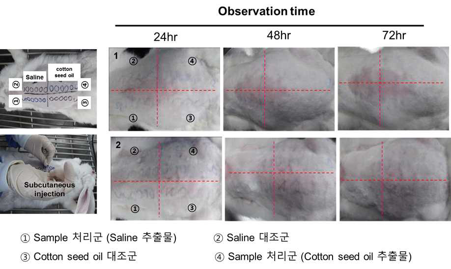 3D 패치 추출액의 피내반응시험 결과