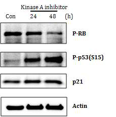 Kinase A inhibitor induce senescence-related proteins