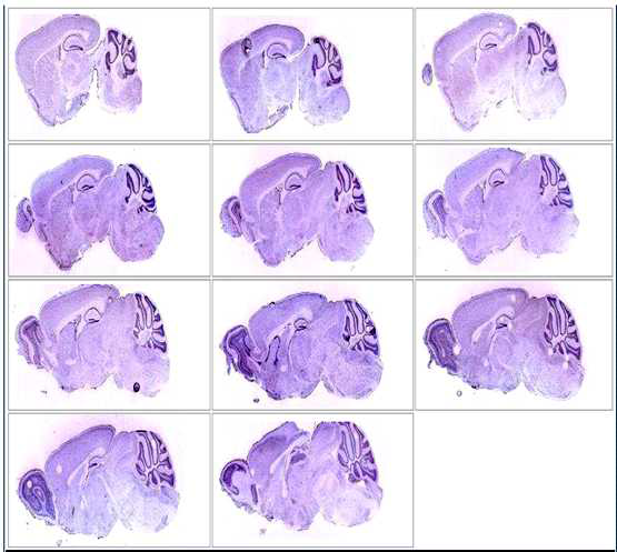 The mRNA expression of JHD in the rat brain from Allen atlas