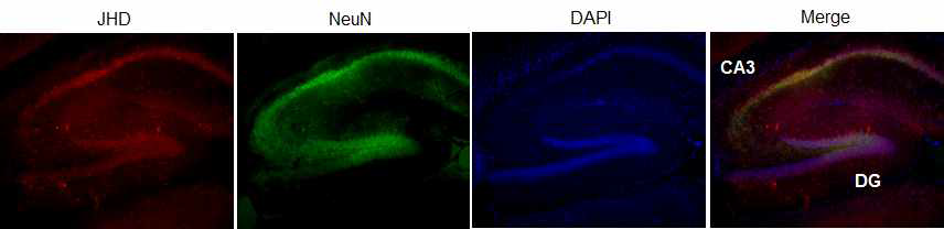 Colocalization of JHD and NeuN and DAPI staining in hippocampus of brain