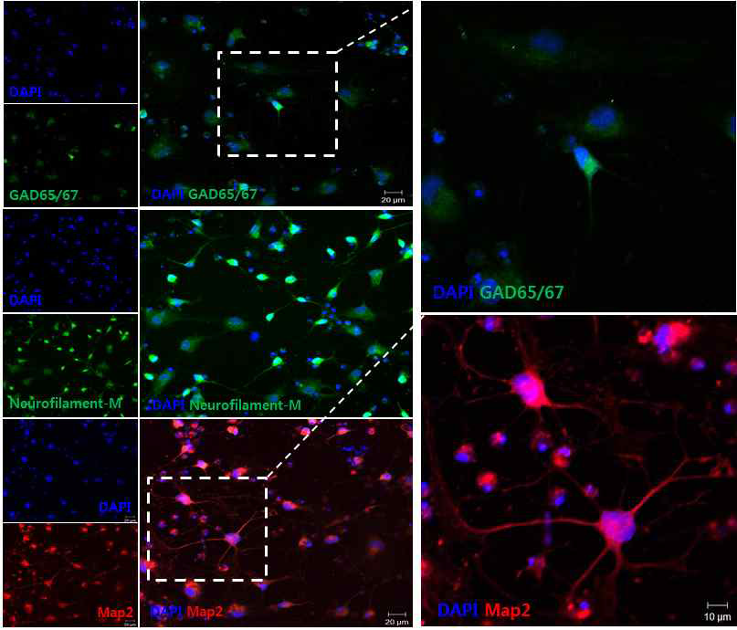 면역형광염색법으로 분화된 신경세포 분석