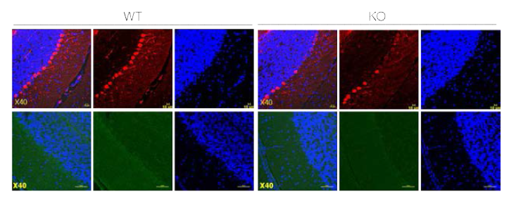 WT, KO 마우스 뇌조직에서의 calbindin (red)과 synapsin (green) 발현 확인
