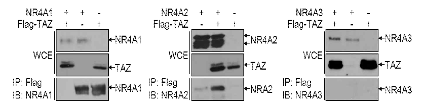 신경세포 분화 조절유전자와 TAZ 상관성 연구