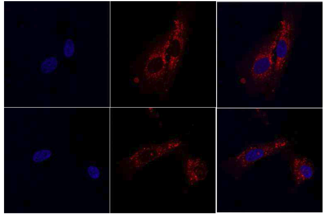 혈관 내피 세포(HUVEC)으로 유입된 MDA-MB-231 세포의 엑소좀의 위치