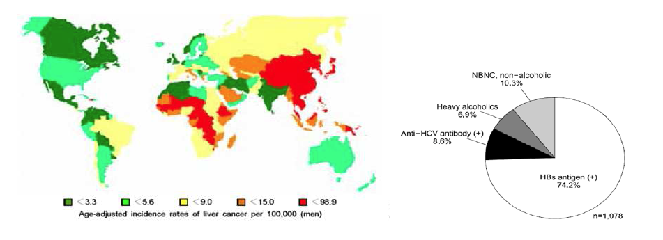 전세계의 간암발생 빈도 (우측) 및 우리나라 간암의 발생원인 (좌측)