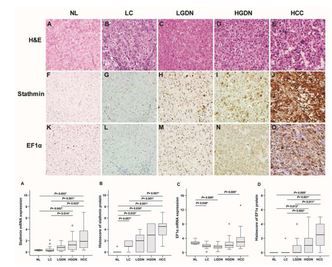 간암 발생 다단계에서 telomere dysfunction 조절인자의 mRNA와 단백질 발현의 변화