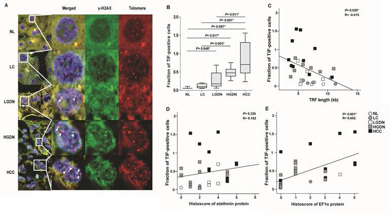 인체 간암 다단계 발생에서 telomere dysfunction의 변화와 telomere dysfunction 조절인자와의 상관 관계