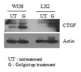 Endogenous expression of CTGF in WI-38 and LX2