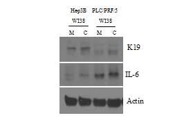 노화 세포주(W-CTGF)와의 co-culture가 간암세포의 stem cell marker (K19)와 SASP factor (IL-6)에 미치는 영향
