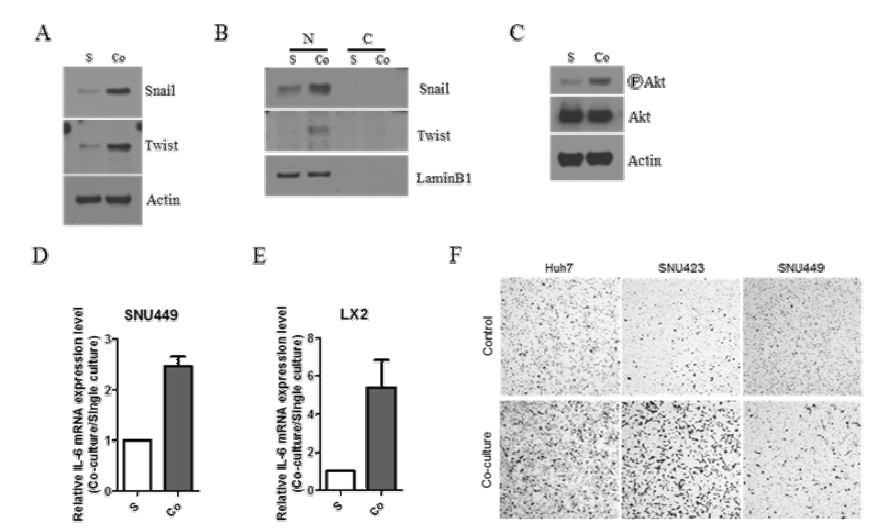 Co-culture model에서 EMT regulator인 Snail, Twist의 nuclear expression 증가 및 Akt pahtway의 activation, 그리고 migration의 증가가 관찰됨.