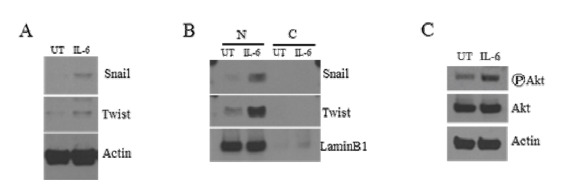 Recombinant IL6 treatment시, co-culture model에서 관찰하였던 Snail, Twist의 증가, Akt pathway의 활성화가 동일한 양상으로 나타남.