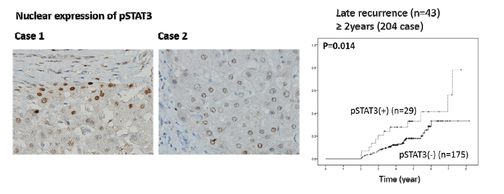 종양 주변 간조직에서 pSTAT3의 발현에 따른 late recurrence (>2 years)의 발생 비교