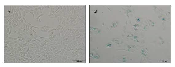 Cultured progenitor cell과 hepatocyte에서의 Senescence 관찰.
