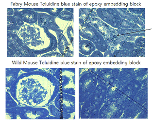 Fabry mouse kidney의 toluidine blue 염색