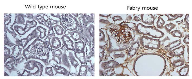 Immunohistochemistry에 의한 Wild type 및 Fabry mouse kidney 에서의 globotriaosyceramide (Gb3) 발현 비교