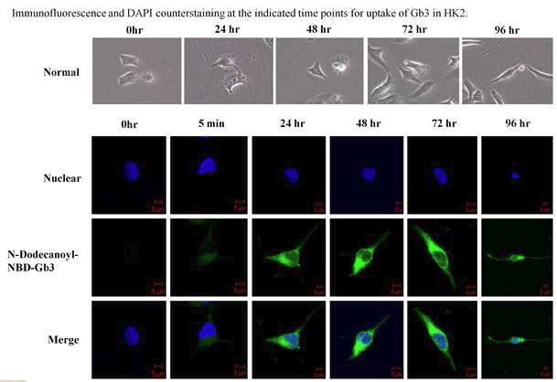 HK2 cell에 형광표지-Gb3를 처리하였을 때, 시간에 따른 세포의 형태 변화 및 세포내 Gb3의 위치 확인