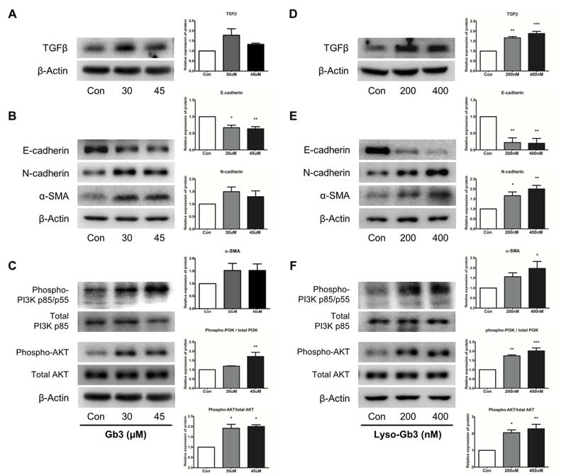 HK2 cell에서 Gb3와 lyso-Gb3를 처리하였을 때, TGF-β, E-cadherin, N-cadherin과 α-SMA, PI3K/Akt의 발현을 확인함