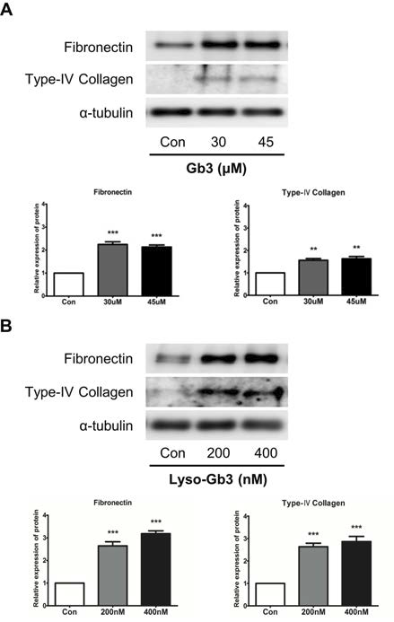 HK2 cell에서 Gb3와 lyso-Gb3처리에 의한 Fibronectin과 type IV collagen의 발현 확인.