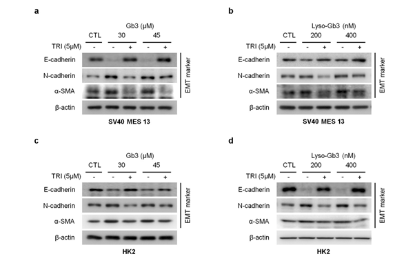 HK2 cell과 SV40 MES 13 cell에서 Gb3와 lyso-Gb3에 의해 유발된 EMT 마커의 발현이 TGF-β receptor inhibitor (TRI)에 의하여 억제되는 것을 확인함.