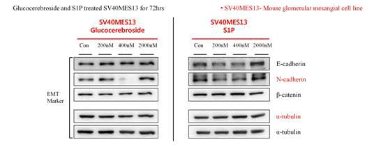 SV40MES13 cell에 glucocerebroside, S1P를 처리하였을 때의 EMT 관련 유전자의 변화