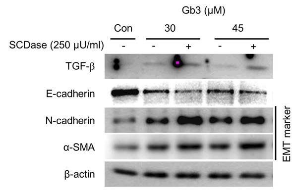 Gb3와 SCDase 처리한 HK2 cell에서의 EMT 마커의 발현